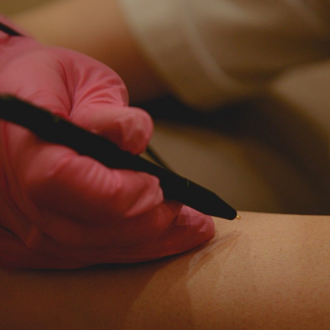Electrolysis - Hair Removal