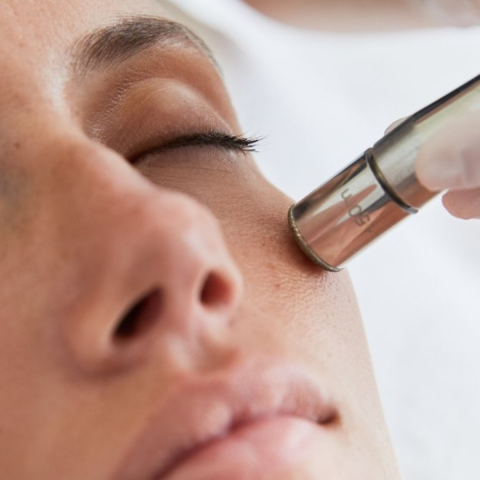 Microdermabrasion Facial