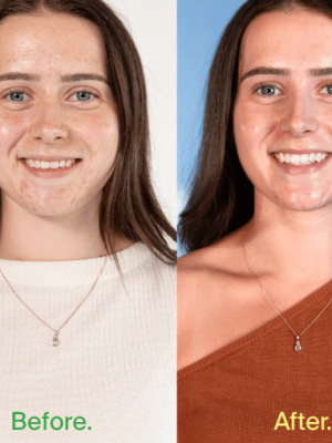 Be Pure Skin Rescue 30-day Supply